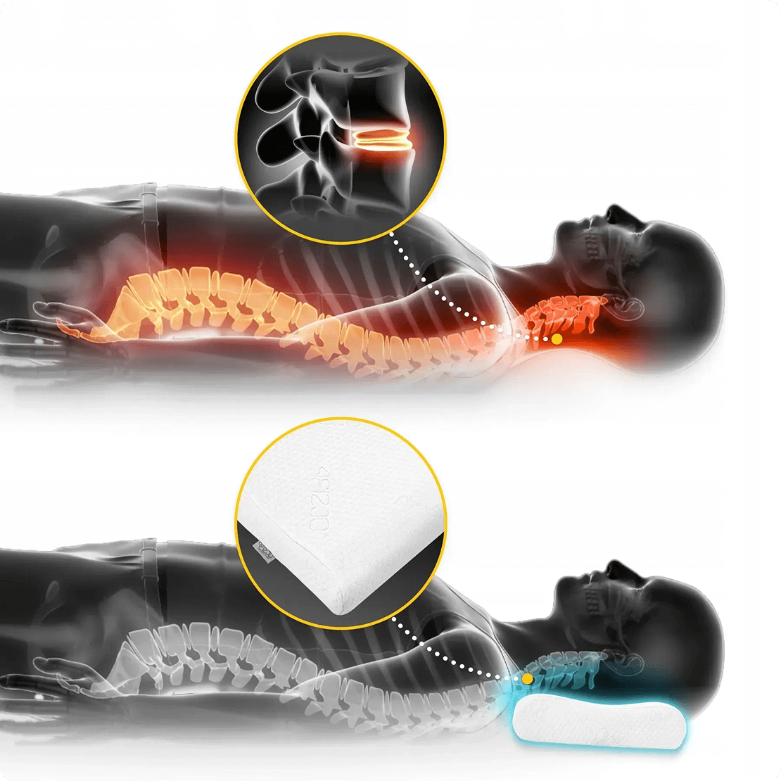 alt="Woman sleeping on Spino pillow – relieves neck and shoulder tension"